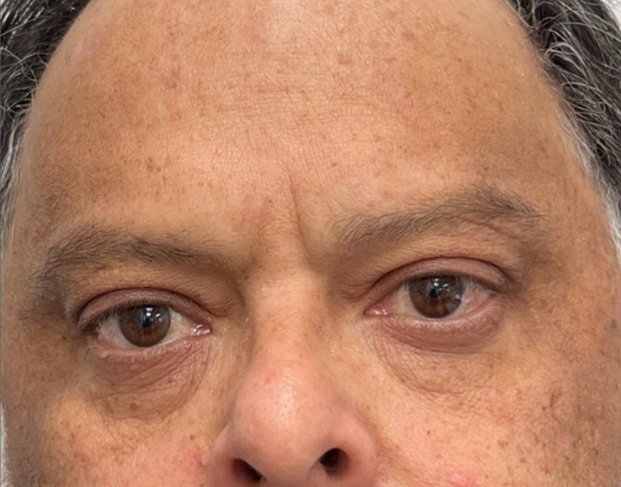 Titre — Après
